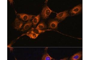 Immunofluorescence (IF) image for anti-Serpin Peptidase Inhibitor, Clade G (C1 Inhibitor), Member 1 (SERPING1) antibody (ABIN7259610)