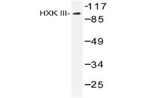 Western blot (WB) analysis of HXK III antibody in extracts from Jurkat insulin 0.