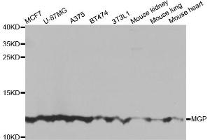 Western blot analysis of extracts of various cell lines, using MGP antibody (ABIN5975376) at 1/1000 dilution. (MGP antibody)