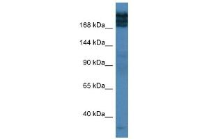 Western Blot showing TPR antibody used at a concentration of 1 ug/ml against Fetal Lung Lysate (TPR antibody  (C-Term))