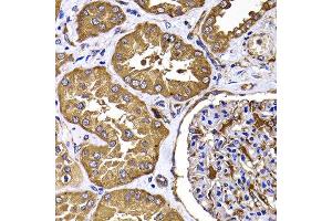 Immunohistochemistry of paraffin-embedded human kidney using TGS1 antibody at dilution of 1:100 (40x lens). (TGS1 antibody)