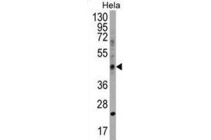 Western Blotting (WB) image for anti-Chitinase Domain Containing 1 (CHID1) antibody (ABIN2999239)