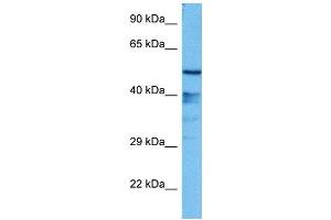 Host:  Mouse  Target Name:  GFI1  Sample Tissue:  Mouse Liver  Antibody Dilution:  1ug/ml (GFI1 antibody  (N-Term))