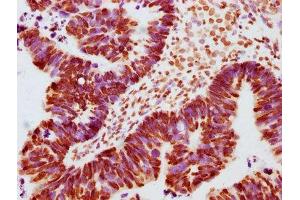 Immunohistochemistry (IHC) image for anti-Janus Kinase 2 (JAK2) (pTyr1007), (pTyr1008) antibody (ABIN7127703)