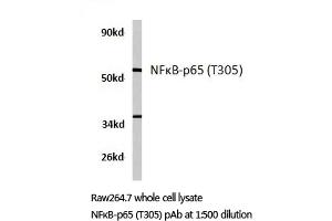 Western blot (WB) analyzes of NFκB-p65 antibody in extracts from raw264. (NF-kB p65 antibody)