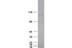 Validation with Western Blot (Exportin 2 Protein (Myc-DYKDDDDK Tag))