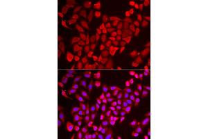 Immunofluorescence analysis of U2OS cells using TNP2 antibody.