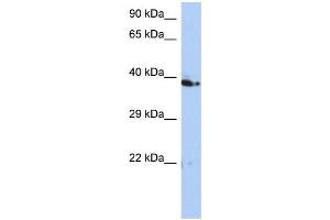 WB Suggested Anti-C10orf46 Antibody Titration: 0. (CACUL1 antibody  (Middle Region))