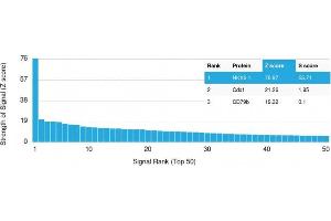 Analysis of Protein Array containing more than 19,000 full-length human proteins using NKX6. (NKX6-1 antibody)