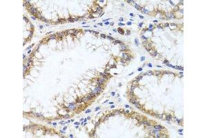 Immunohistochemistry of paraffin-embedded Human stomach using GPM6A Polyclonal Antibody at dilution of 1:100 (40x lens). (GPM6A antibody)