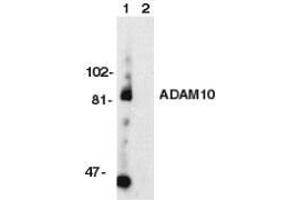 Western blot analysis of ADAM10 in Jurkat whole cell lysate with ADAM10 antibody at 1ug/ml Immunocytochemistry: use at 1-5ug/ml