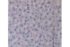 Figure. (CHGB antibody  (AA 315-482))