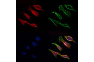 ABIN6257028 and ABIN6275977 staining Hela cells by IF/ICC. (CCZ1B antibody  (N-Term))