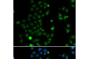 Immunofluorescence analysis of MCF-7 cells using GCM1 Polyclonal Antibody (GCM1 antibody)