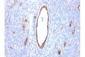 Formalin-fixed, paraffin-embedded human Tonsil stained with vWF Recombinant Mouse Monoclonal Antibody (rVWF/2480). (Recombinant VWF antibody)
