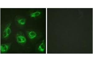 Immunofluorescence analysis of HeLa cells, using Calsenilin/KCNIP3 (Ab-63) Antibody. (DREAM antibody  (AA 29-78))