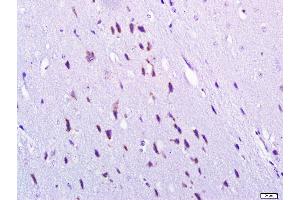 Paraformaldehyde-fixed, paraffin embedded Mouse brain, Antigen retrieval by boiling in sodium citrate buffer (pH6. (gamma 1 Adaptin antibody  (AA 721-822))