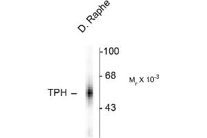 Western blots of human dorsal Raphe nucleus showing specifc immunolabeling of the ~55k tryptophan hydroxylase protein. (Tryptophan Hydroxylase 1 antibody)