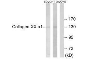 Western blot analysis of extracts from HUVEC cells, using Collagen XX α1 antibody.