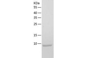 Western Blotting (WB) image for Secretoglobin, Family 2A, Member 2 (SCGB2A2) (AA 19-93) protein (His tag) (ABIN7125005)