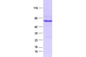 Western Blotting (WB) image for EPH Receptor A3 (EPHA3) protein (DYKDDDDK Tag) (ABIN2720237)