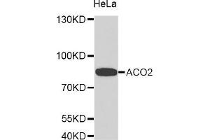 Western Blotting (WB) image for anti-Aconitase 2, Mitochondrial (ACO2) (AA 501-780) antibody (ABIN1678537) (ACO2 antibody  (AA 501-780))