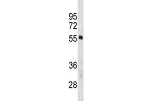 PTBP1 antibody western blot analysis in MCF-7 lysate. (PTBP1 antibody  (AA 26-55))