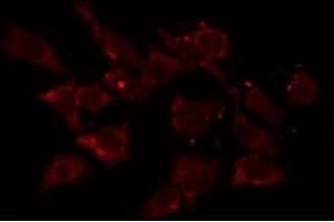 ABIN6275762 staining HepG2 by IF/ICC. (Cytochrome C1 antibody  (Internal Region))
