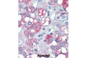 Formalin-fixed and paraffin-embedded human adrenalreacted with PDK4 polyclonal antibody , which was peroxidase-conjugated to the secondary antibody, followed by AEC staining. (PDK4 antibody  (C-Term))