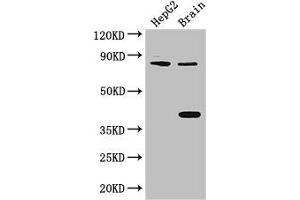 Western Blot Positive WB detected in: HepG2 whole cell lysate, Mouse brain tissue All lanes: FIGN antibody at 3 μg/mL Secondary Goat polyclonal to rabbit IgG at 1/50000 dilution Predicted band size: 83 kDa Observed band size: 83, 38 kDa (Fidgetin antibody  (AA 132-371))