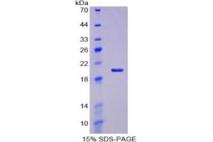 SDS-PAGE of Protein Standard from the Kit  (Highly purified E. (Aggrecan ELISA Kit)