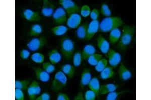 IF analysis of HSPA6 using anti-HSPA6 antibody (ABIN7601944).