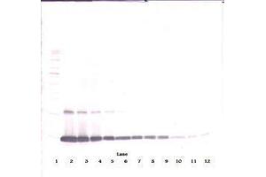 Image no. 2 for anti-Colony Stimulating Factor 2 (Granulocyte-Macrophage) (CSF2) antibody (ABIN465581) (GM-CSF antibody)