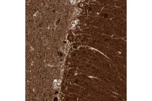 Immunohistochemical staining of human cerebellum with ZNF512 polyclonal antibody  shows strong cytoplasmic and nucleolar positivity in Purkinje cells. (ZNF512 antibody)