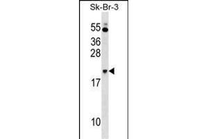 NKIRAS1 Antibody (Center) (ABIN1538446 and ABIN2849067) western blot analysis in SK-BR-3 cell line lysates (35 μg/lane). (NKIRAS1 antibody  (AA 48-76))