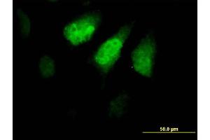 Immunofluorescence of purified MaxPab antibody to ZNF259 on HeLa cell. (ZNF259 antibody  (AA 1-459))