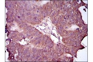 Immunohistochemistry (IHC) image for anti-EGFR Mutant (AA 693-893), (Mutant) antibody (ABIN1845729) (EGFR Mutant (AA 693-893), (Mutant) antibody)