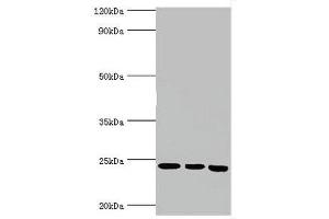 Western blot All lanes: BAG family molecular chaperone regulator 2 antibody at 6 μg/mL Lane 1: Jurkat whole cell lysate Lane 2: Hela whole cell lysate Lane 3: HepG2 whole cell lysate Secondary Goat polyclonal to rabbit IgG at 1/10000 dilution Predicted band size: 24, 21 kDa Observed band size: 24 kDa (BAG2 antibody  (AA 1-211))