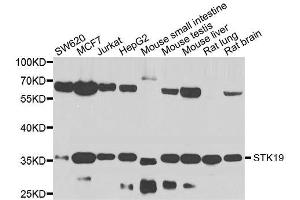 Western blot analysis of extracts of various cell lines, using STK19 antibody. (STK19 antibody  (AA 75-364))