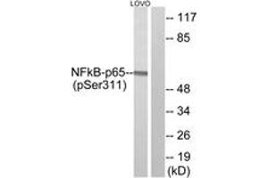 Western blot analysis of extracts from LOVO cells treated, using NF-kappaB p65 (Phospho-Ser311) Antibody. (NF-kB p65 antibody  (pSer311))