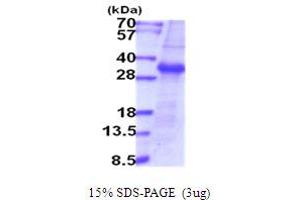 SDS-PAGE (SDS) image for Transmembrane Protease, serine 15 (TMPRSS15) (AA 785-10199) protein (ABIN5854071)