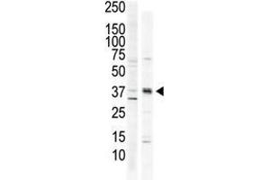 The anti-CAMK1 C-term Pab is used in Western blot to detect CAMK1 in HeLa cell lysate (lane 1) and primate brain tissue lysate (lane 2). (CAMK1 antibody  (C-Term))