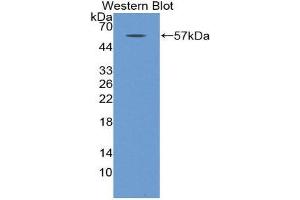 Western Blotting (WB) image for anti-Myosin Heavy Chain 2, Skeletal Muscle, Adult (MYH2) (AA 1238-1472) antibody (ABIN1859925) (MYH2 antibody  (AA 1238-1472))
