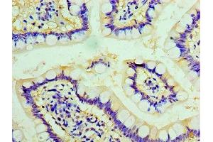 Immunohistochemistry of paraffin-embedded human small intestine tissue using ABIN7147728 at dilution of 1:100 (Chromogranin A antibody  (AA 19-457))