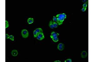 Immunofluorescence staining of MCF-7 cells with ABIN7150062 at 1:133, counter-stained with DAPI. (ADAM8 antibody  (AA 677-824))
