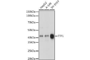 Western blot analysis of extracts of various cell lines, using TTF1 antibody (ABIN1679475, ABIN3017648, ABIN3017649 and ABIN7101514) at 1:1000 dilution. (NKX2-1 antibody)