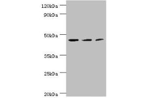 Western blot All lanes: ACY1 antibody at 4 μg/mL Lane 1: K562 whole cell lysate Lane 2: HepG2 whole cell lysate Lane 3: Mouse kidney tissue Secondary Goat polyclonal to rabbit IgG at 1/10000 dilution Predicted band size: 46, 38, 39, 43 kDa Observed band size: 46 kDa (Aminoacylase 1 antibody  (AA 1-408))