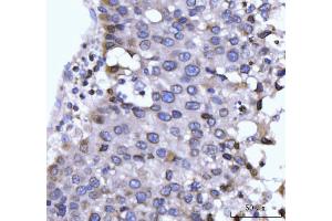 IHC analysis of GP210/NUP210 using anti-GP210/NUP210 antibody (ABIN7600707).