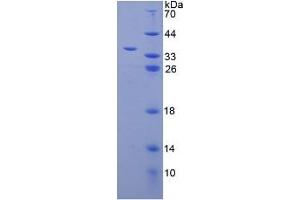 SDS-PAGE analysis of Human LMAN1 Protein. (LMAN1 Protein)