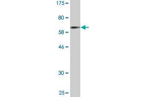 Western Blot detection against Immunogen (67. (Cathepsin E antibody  (AA 18-396))